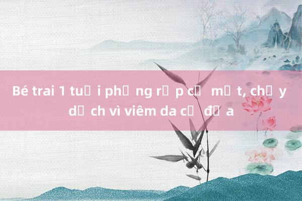 Bé trai 1 tuổi phồng rộp cả mặt, chảy dịch vì viêm da cơ địa